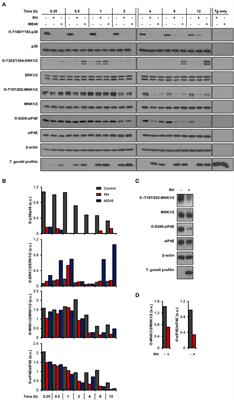 Infection by the Protozoan Parasite Toxoplasma gondii Inhibits Host MNK1/2-eIF4E Axis to Promote Its Survival